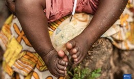 长春猴痘爆料事件视频,揭秘病毒传播与防控挑战